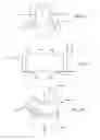 Fig. 16 - INTRA-ORAL LIGHT-THERAPY APPARATUSES AND METHODS FOR THEIR USE