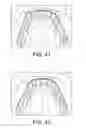 Fig. 22 - INTRA-ORAL LIGHT-THERAPY APPARATUSES AND METHODS FOR THEIR USE