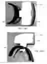 Fig. 78 - INTRA-ORAL LIGHT-THERAPY APPARATUSES AND METHODS FOR THEIR USE