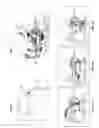 Fig. 03 - Reciprocating rehabilitation device