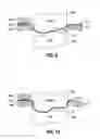 Fig. 05 - Golf club insert
