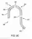 Fig. 07 - STRAINERS
