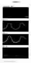 Fig. 44 - Systems and methods for particle focusing in microchannels