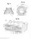 Fig. 02 - Method for stent shaping