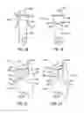 Fig. 08 - Cutting device tooth mounting arrangement