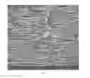 Fig. 08 - Thermoformed article formed from a porous polymeric sheet
