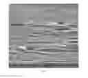 Fig. 10 - Thermoformed article formed from a porous polymeric sheet