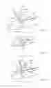 Fig. 05 - WINDSCREEN WIPER UNIT COMPRISING AN ARTICULATED COVER