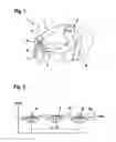 Fig. 02 - Method and device for ascertaining a state of drowsiness of a driver