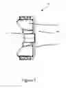 Fig. 07 - DRAFT BOX WEAR LINER