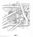 Fig. 08 - Vehicle frame assembly and method of use and manufacture thereof