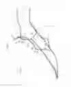 Fig. 10 - Vehicle body structure
