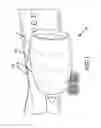 Fig. 02 - Pulsed deicing system