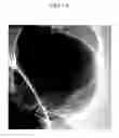 Fig. 07 - Method of carbon coating on nanoparticle and carbon coated nanoparticle produced by the same