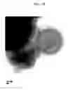 Fig. 08 - Method of carbon coating on nanoparticle and carbon coated nanoparticle produced by the same