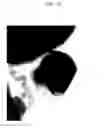 Fig. 28 - Method of carbon coating on nanoparticle and carbon coated nanoparticle produced by the same