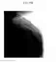 Fig. 99 - Method of carbon coating on nanoparticle and carbon coated nanoparticle produced by the same