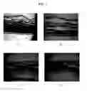 Fig. 02 - Compositions and methods for restoring epidermal integrity and function and treating dermatological diseases