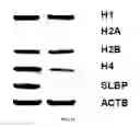 Fig. 14 - TREATING HUMAN IMMUNODEFICIENCY VIRUS INFECTIONS
