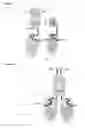 Fig. 06 - SINGLE-CHAIN FUSION POLYPEPTIDE COMPRISING TRAIL