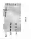 Fig. 33 - TREATMENT AND PROPHYLAXIS OF AMYLOIDOSIS