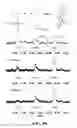 Fig. 63 - Associative polymers for use in a flow and related compositions, methods and systems