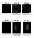 Fig. 04 - Radioopaque, iodine functionalized phenylalanine-based poly(ester urea)s