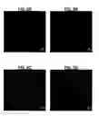 Fig. 07 - Radioopaque, iodine functionalized phenylalanine-based poly(ester urea)s