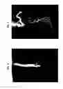 Fig. 03 - Rapid growth activator