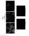 Fig. 12 - DIFFERENTIATION OF HUMAN EMBRYONIC STEM CELLS