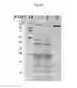 Fig. 09 - GENETIC DETECTION PLATFORM