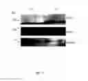 Fig. 14 - Methods for modulating KLHL1 levels, methods for modulating current activity in T-type calcium channels, molecules therefor, and methods for identifying molecules therefor