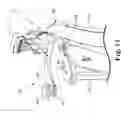 Fig. 19 - Rotor and rotor housing for a snowthrower