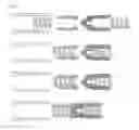 Fig. 07 - REBAR CONNECTOR HAVING A PAIR OF LOCKING PIECES AND CONNECTION METHOD FOR PREFABRICATED REBAR NET USING SAME