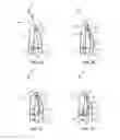 Fig. 04 - Active pivoting window regulator system