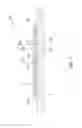 Fig. 02 - DOWNHOLE SEAL