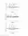 Fig. 04 - METHOD OF IDENTIFYING A FAULTY FUEL INJECTOR IN AN INTERNAL COMBUSTION ENGINE