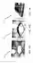 Fig. 14 - Smart braking devices, systems, and methods with resin features