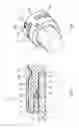 Fig. 05 - Arrangement for producing a pipe connection and holding element for such an arrangement