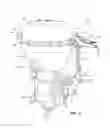 Fig. 05 - Position sensor mounts for a diagnostic system for fluid control valves