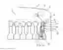 Fig. 01 - INTERNAL COMBUSTION ENGINE AND METHOD FOR DETECTING OPERATING CONDITIONS OF AN INTERNAL COMBUSTION ENGINE