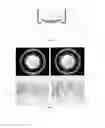 Fig. 03 - System and method for inspecting opthalmic lenses