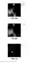 Fig. 05 - Method of observing the emission of light from a sample by dynamic optical microscopy