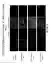 Fig. 17 - Methods of propagating rhinovirus C in previously unsusceptible cell lines
