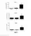 Fig. 08 - Methods for Inhibiting Epithelial to Mesenchymal Transition by Inhibition of FOXS1