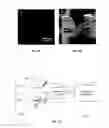 Fig. 02 - METHOD AND SYSTEM FOR MICROFILTER-BASED CAPTURE AND RELEASE OF CANCER ASSOCIATED CELLS