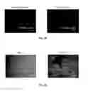 Fig. 04 - METHOD AND SYSTEM FOR MICROFILTER-BASED CAPTURE AND RELEASE OF CANCER ASSOCIATED CELLS