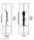 Fig. 05 - Electrical system with arc fault detection