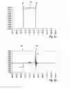 Fig. 05 - Method for detecting anomalies in a battery cell, and short-circuit sensor system