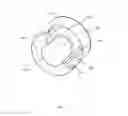 Fig. 04 - Displacer in magnetic resonance imaging system